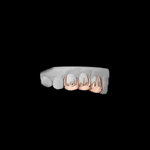 custom-grillz-3